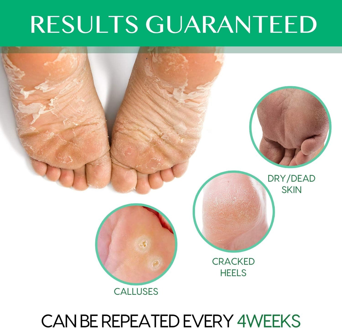 meeye® foot peel mask